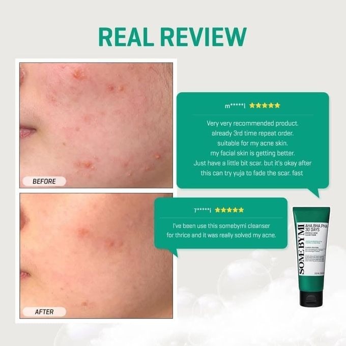 Some By Mi AHA-BHA-PHA 30 Days Miracle Acne Clear Foam 100ml