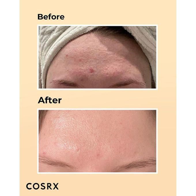 COSRX Advanced Snail 96 Mucin Power Essence, 100ml